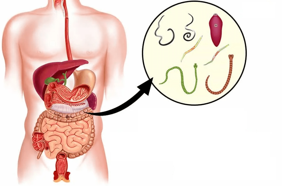 Cacing dan cacing di saluran pencernaan