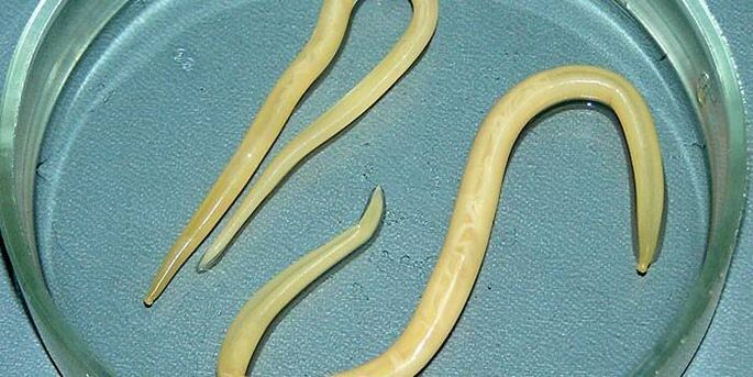Cacing gelang manusia dalam cawan Petri - parasit di dinding usus kecil