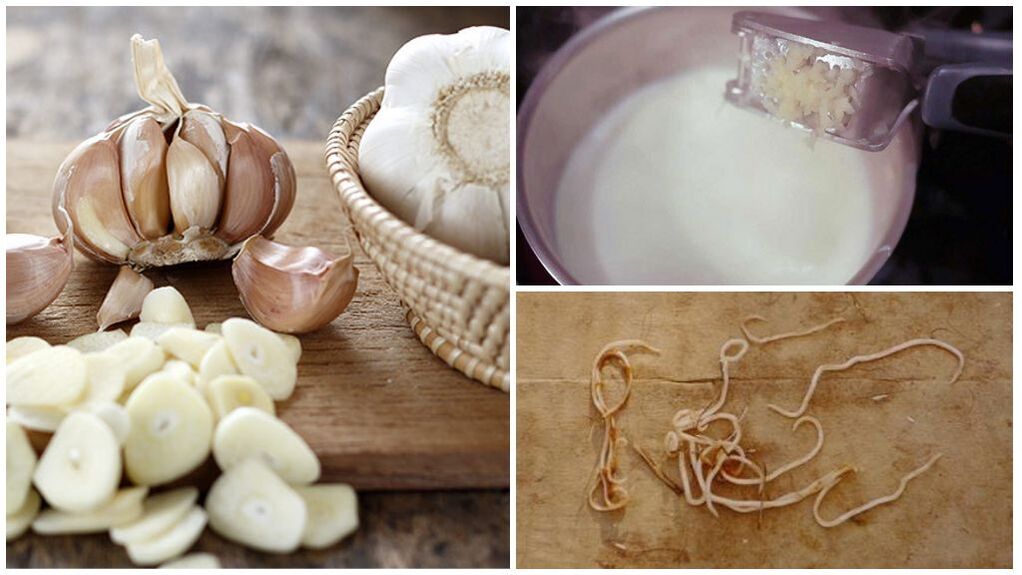 Susu dengan bawang putih - obat tradisional untuk cacingan pada anak-anak