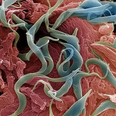 Berbagai parasit yang hidup di tubuh manusia