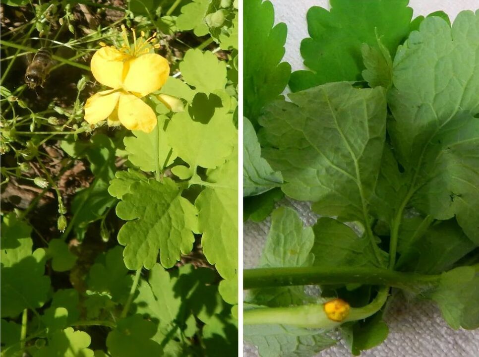 celandine melawan parasit