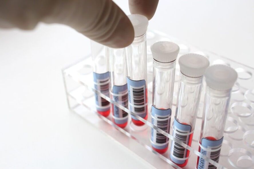 diagnosis parasit dalam tubuh