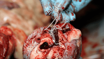 Helminths di hati
